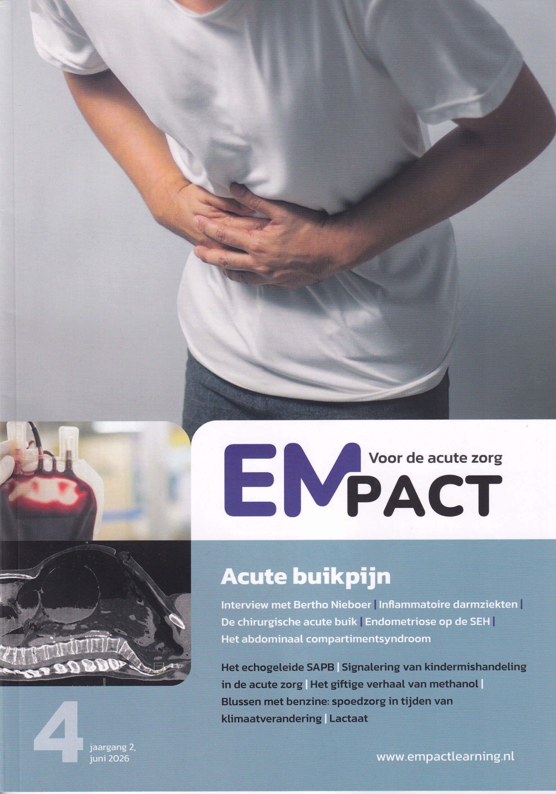 EMPACT 2026-4